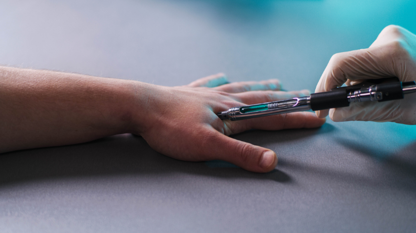 What You Should Know About RFID Implant - RFID Card